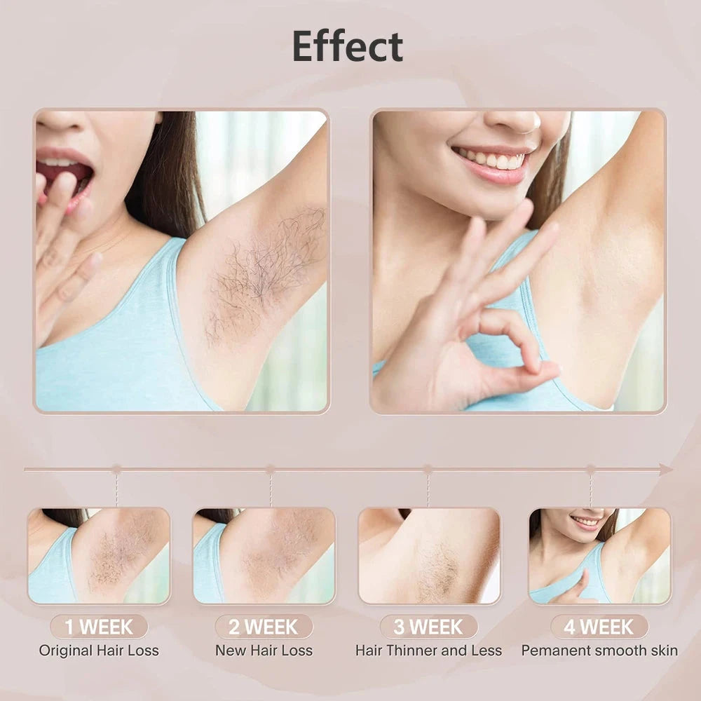 Depiladora láser para mujer, depilación indolora para axila, Bikini, cuerpo, pierna, brazo, 990000 Flashes