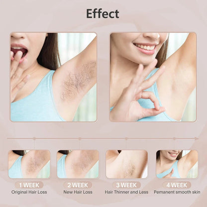 Depiladora láser para mujer, depilación indolora para axila, Bikini, cuerpo, pierna, brazo, 990000 Flashes