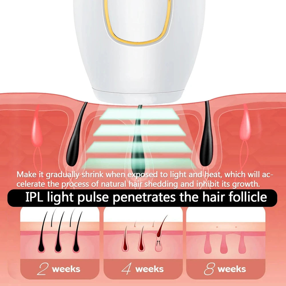 Depiladora láser para mujer, depiladora láser permanente para uso doméstico